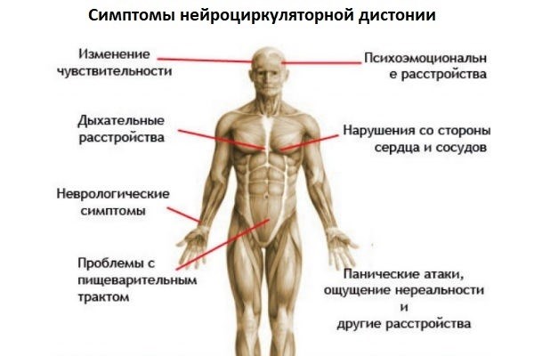 Симптомы заболевания